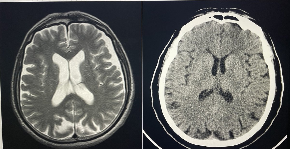 Bi görüntülerden biri erkek diğeri kadın ve 45 yıllık evlilik sonrası aynı gün çekilen filmler hangisi ereke hangisi kadın ?