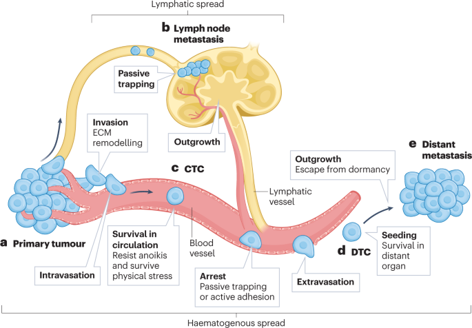 NEW content online! Dissecting metastasis using preclinical models and methods dlvr.it/SnStjX