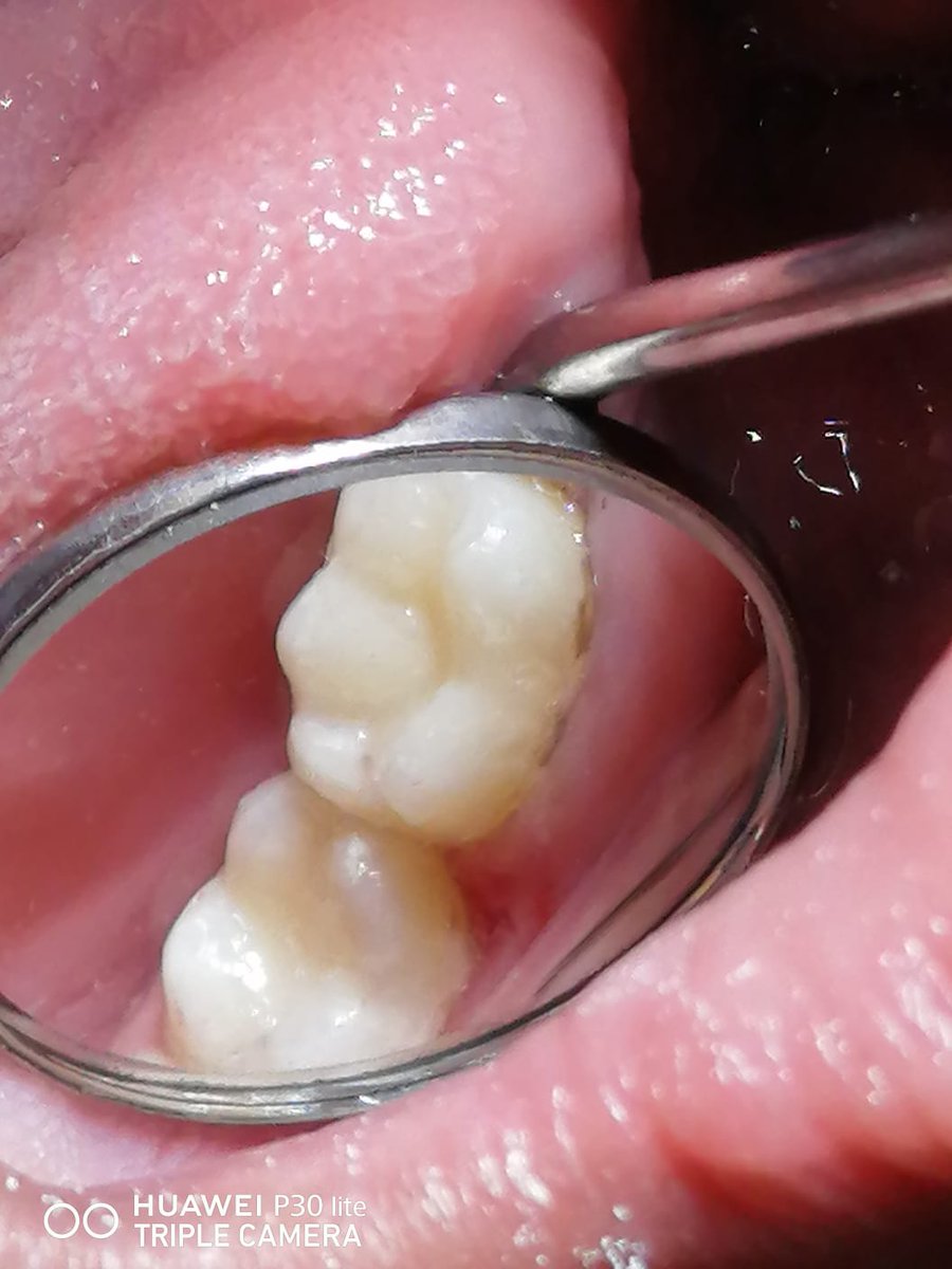 urfavghada5's tweet photo. Last operative case 🥰 https://t.co/95ROzA48K2