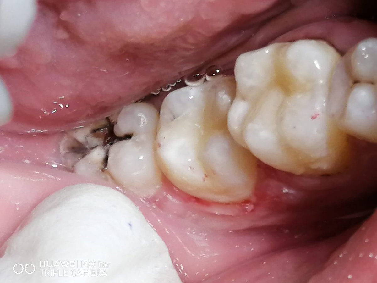 urfavghada5's tweet photo. Last operative case 🥰 https://t.co/95ROzA48K2
