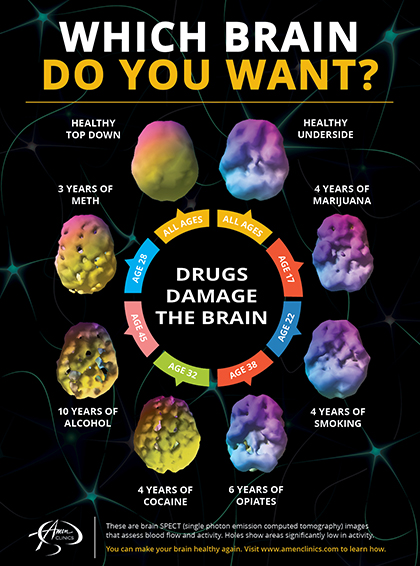 https://www.amenclinics.com/blog/10-ways-brain-scans-can-help-with-addictions/