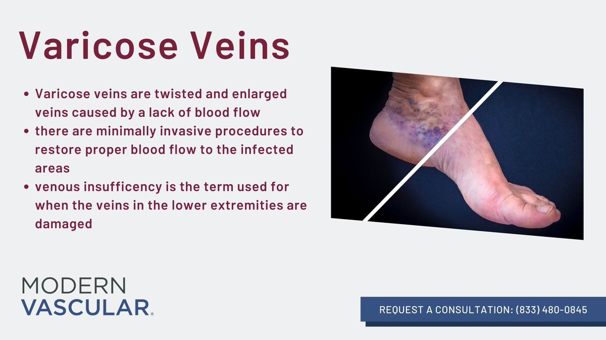 Modern Vascular treats venous insufficiency through minimally invasive procedures. To learn more, contact a patient advocate today: (833) 480-0845

#veins #VariocseVeins #VenousInsufficency #VeinHealth
