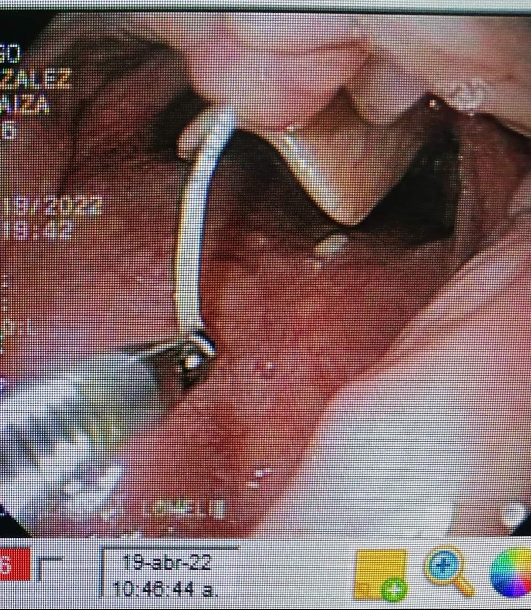 DrLeonNava's tweet photo. @drkeithsiau Probably its best if you take the free tip first https://t.co/VYOTeczAyR
