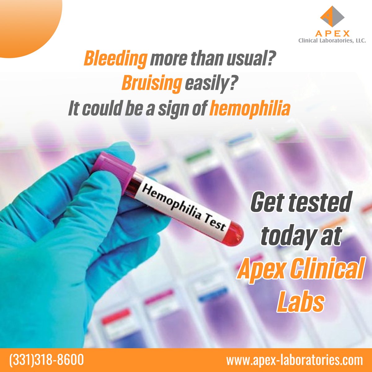ClinicalApex's tweet photo. Iron is a mineral that helps your body make hemoglobin, which carries oxygen to your muscles and organs. Without enough iron, your body can't function at its best
Get your lab test done today!
Call: (331)318-8600
#IronTesting #AnemiaAwareness #ApexClinicalLabs #cts #Poweredbycts https://t.co/Hcer4gh1S6