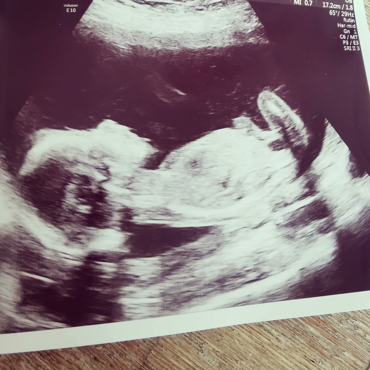 My most important chapter in life begins this Autumn. Can't wait to see this little nerd &lt;3