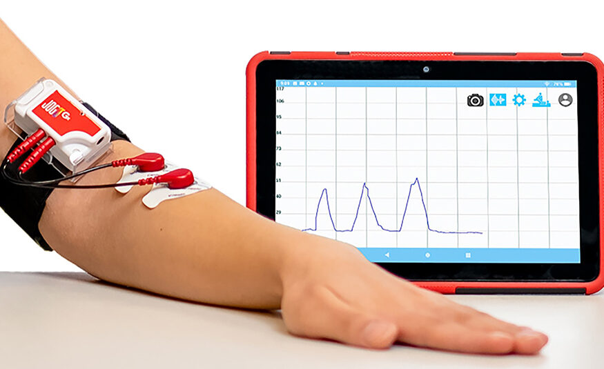 approvals, #fdabreakthroughs

~@FemasysInc’ #FemCerv endocervical tissue sampler for #CervicalCancer diagnosis approved in Canada

~#DirectSync  receives #BreakthroughDeviceDesignation

~@HealthJogo receives #fdabreakthrough for #DigitalTherapy for chronic #LowerBackPain