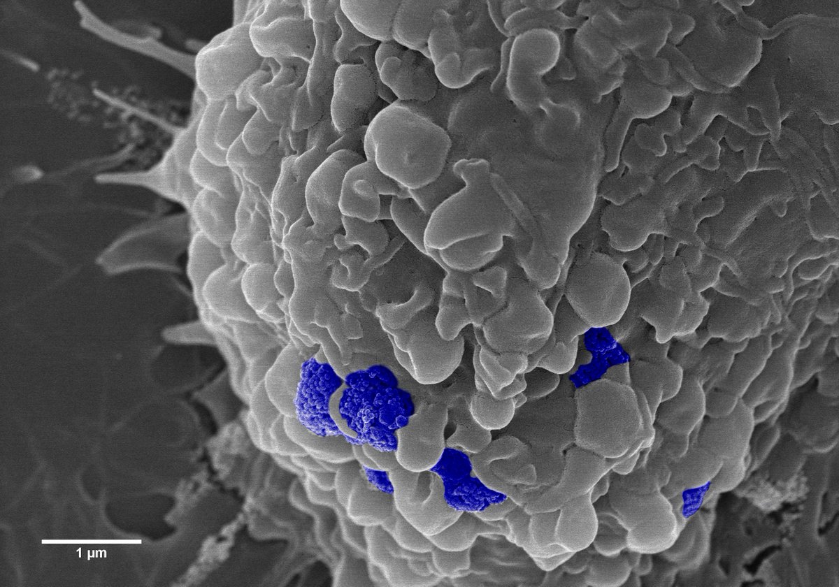 📢 Magnetism as Art

2 - You have a magnetosome on your face 

#Intermag2023 
<a href="/IEEEMagSoc/">IEEE MagSoc</a>