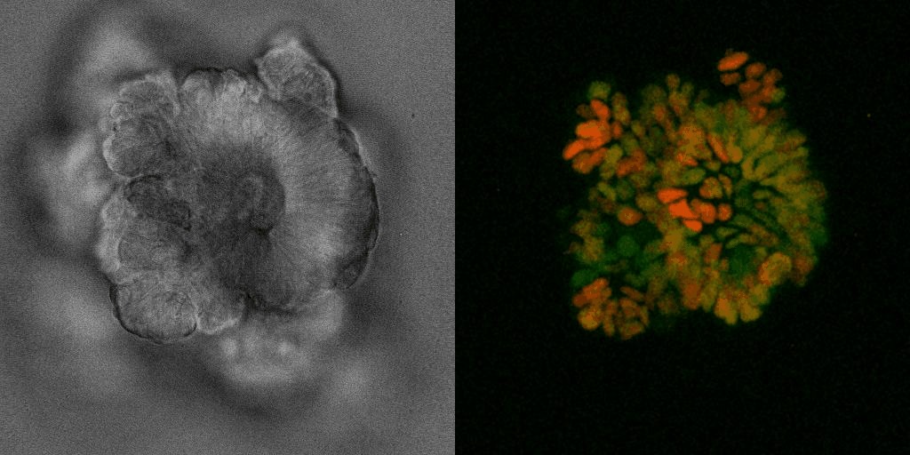 MariaRodrColman's tweet photo. 📣 We are hiring!
We are looking for a postdoc to join our team. Are you interested in how metabolism regulates cell decisions in cancer and development? #metabolism #cancer #organoids Exciting and multidisciplinary research environment @UMCU_CMM!
Check:
https://t.co/pYlKK63CdK https://t.co/lfrIrdPUwk