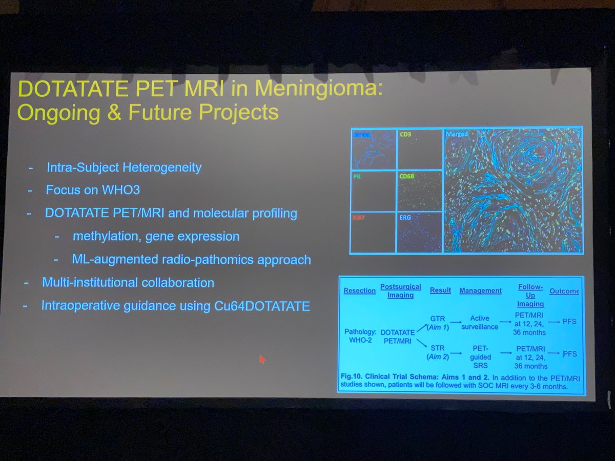 Lets #DOTATATE it! @jana_ivanidze sharing her expertise on DOTATATE PET/MRI @theASFNR Special Program Session @TheASNR #ASNR23 “Application of DOTATATE PET/MRI to meningiomas and paragangliomas: implications for targeted therapy and theranostics”