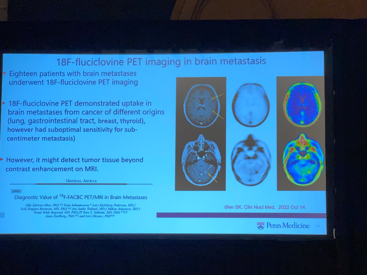 #Fluciclovine is the New Kid on the Block in NeuroOncology! @Ali_Nabavizadeh presenting his seminal work on 18F-Fluciclovine PET to image tumor heterogeneity in HGG & #BrainMets @theASFNR Special Program Session @TheASNR #ASNR23 #diagnosis #targeted_therapy #clinical_translation