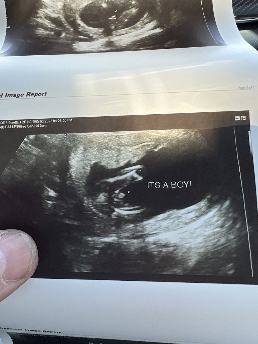 billyerne's tweet photo. I’m gonna be a boy dad https://t.co/0cW9Rdiy3Q