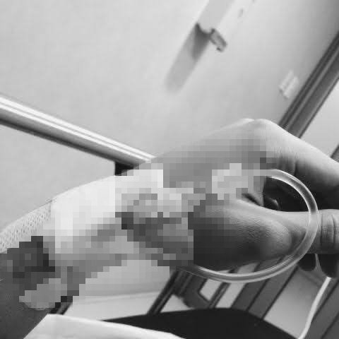 su işi lütfen stajyer çocuklar yapmasın insan hastaligini unutup kolunun derdine düşüyor.😡