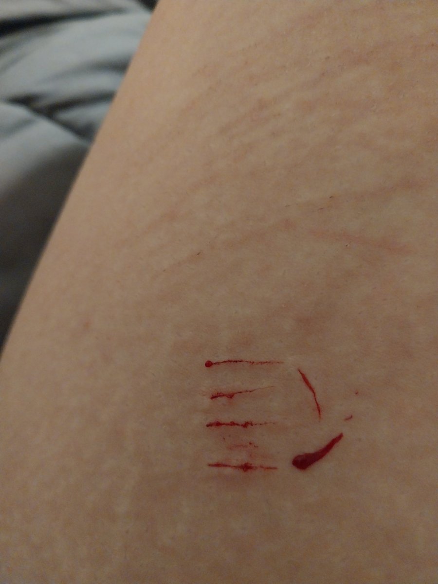 lov3slvt's tweet photo. I'm gonna kms https://t.co/QK7swol17P