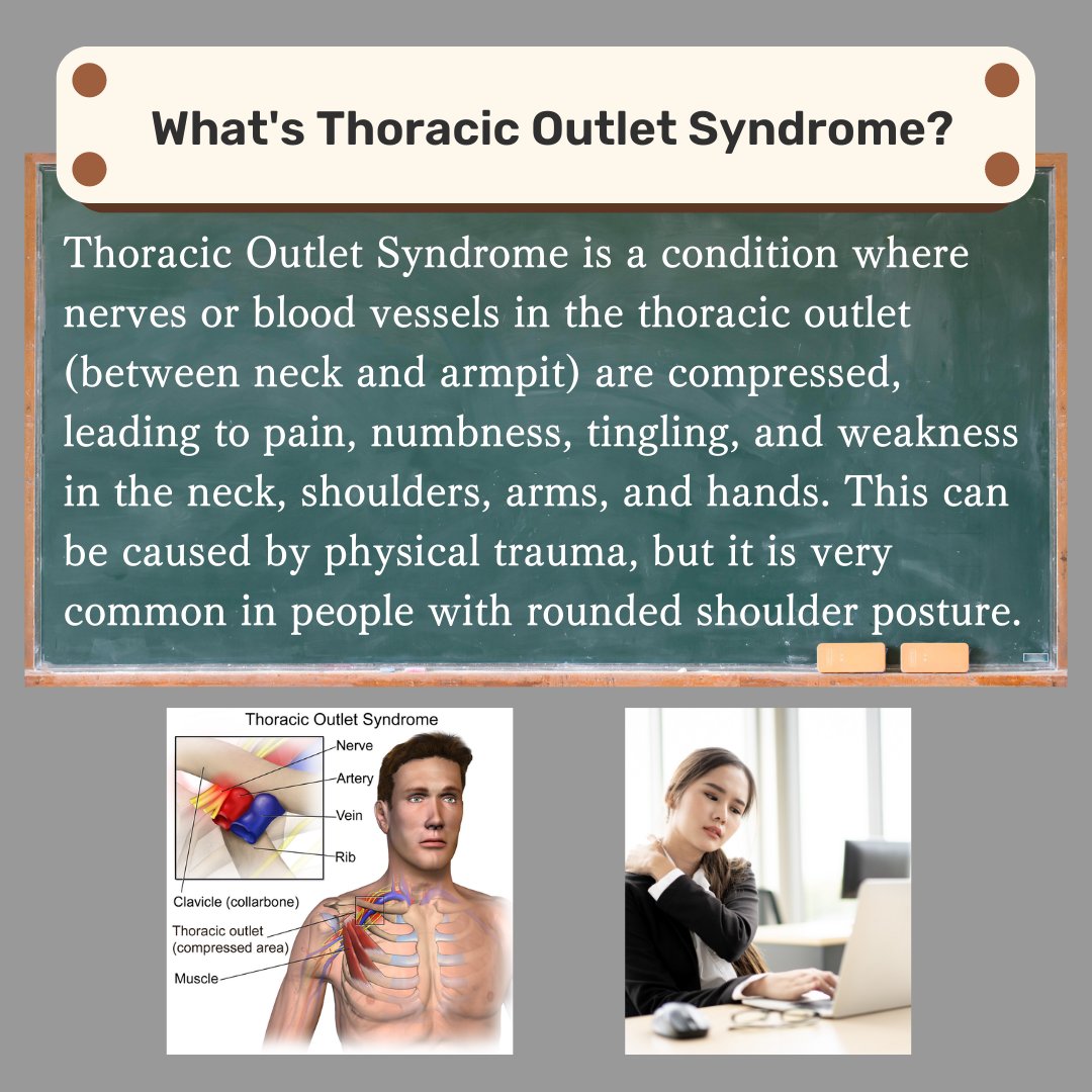 Physiohub101's tweet photo. Do you have symptoms like this?
Do Life Smart with Evidence💡

#PhysioHub #Evidence #Fitness #Health #Science #Physicaltherapy #healthy #lifestyle #wellness #ThoracicOutletSyndrome https://t.co/jQmbir78d7