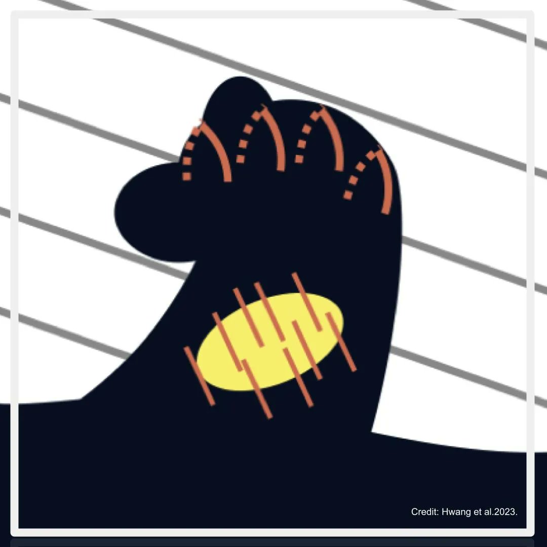 A schematic view of the Horsehead Nebula. The starless core (the "lump" in the throat is shown as a yellow ellipse. The red lines show magnetic field lines within the "lump" and at the top of the #Horsehead nebula (the "mane") as detected by #JCMT.  More: buff.ly/3Vzg2Cy