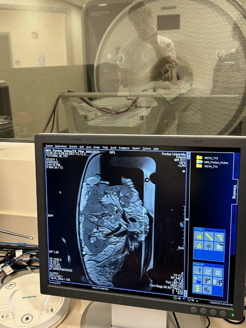 Excited to be collaborating with 34Lives and University of Groningen to study ex-vivo kidney perfusion working towards improving transplant odds!
