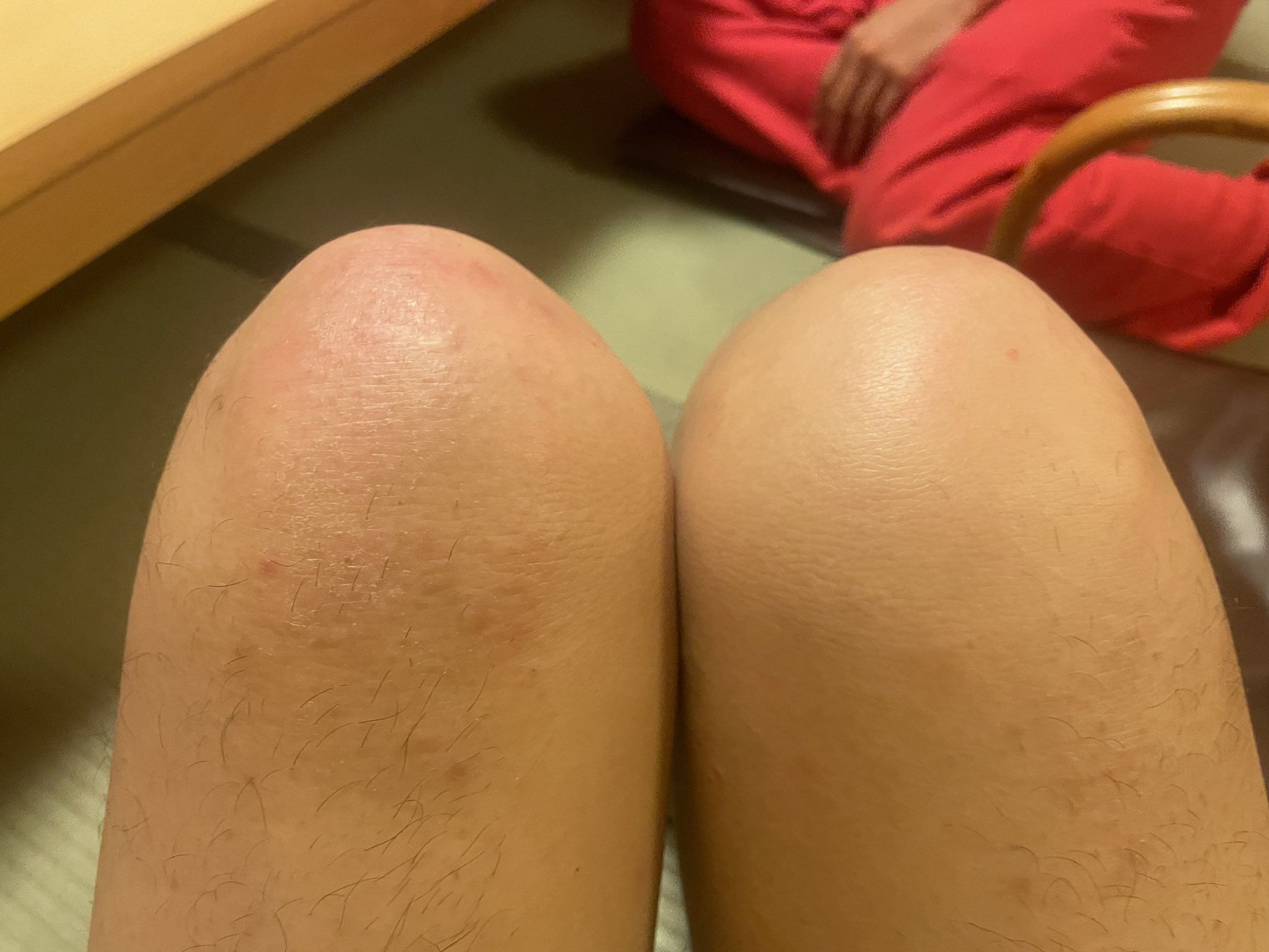 膝小僧お仕置きストしんぺー on X: 