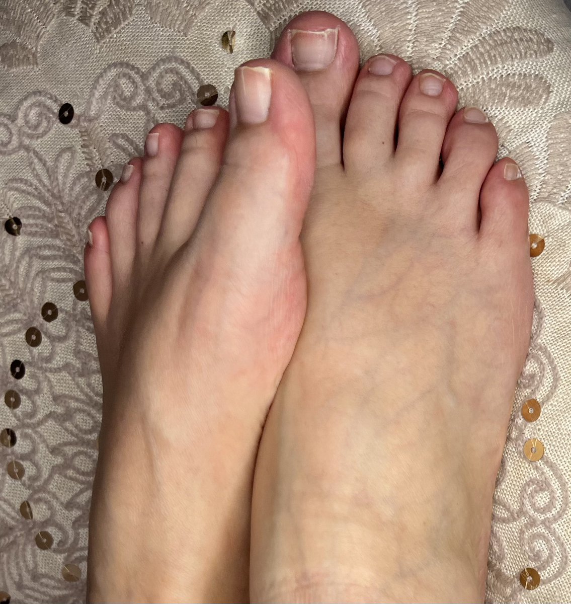 FeetMat2's tweet photo. #sole #solesfeet #solefetish #chubbyfeet #curvyfeet #womensfeet #womenfeet #footgirl #girlsfeet #toenails #toefetish #heels #feetarch #asianfeet #desifeet #desifeetgram #smoothsoles https://t.co/tCzCwNH6en