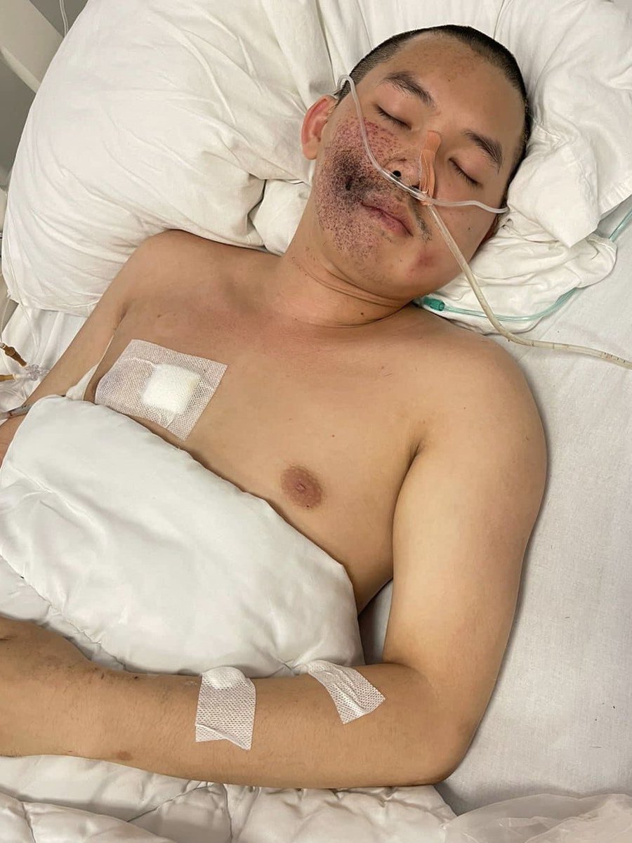 แก้ไข! (4 พ.ค. 66) ‘แจ็ค อะโนซา’ นักกิจกรรมประชาธิปไตยชาวลาว ถูกยิงบาดเจ็บสาหัส แต่ยังไม่ตาย ตอนแรกครอบครัวให้ข่าวว่าตายเพราะกลัวมือปืนจะย้อนกลับมายิงซ้ำ ยูเอ็น และนานาชาติเรียกร้องให้รัฐบาลลาวดูแลความปลอดภัย และเร่งสืบสวนคลี่คลายคดีนี้โดยด่วน #ส่องทวิตยามเช้า