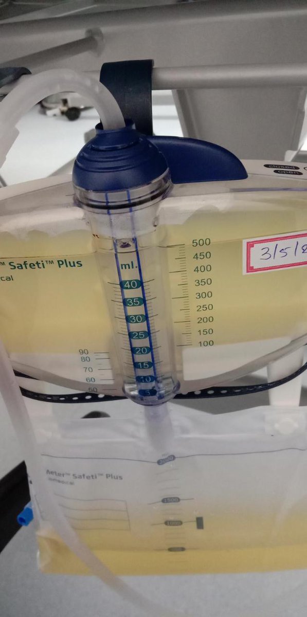 sundar_s1955's tweet image. Even after 40 years and after 3000
kidney Transplants as a Transplant Nephrologist I am overwhelmed to see urine like this immediately after kidney transplant
This Transplant Done yesterday
for a young lady 🙏🙏 to her mother the donor
Picture taken just few hours after…