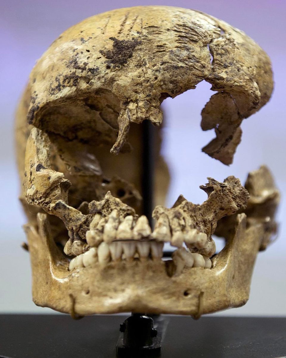 Skull of a 14-year-old girl showing butchery marks, evidence that the starving settlers of Jamestown Colony practiced cannibalism in the Winter of 1609.