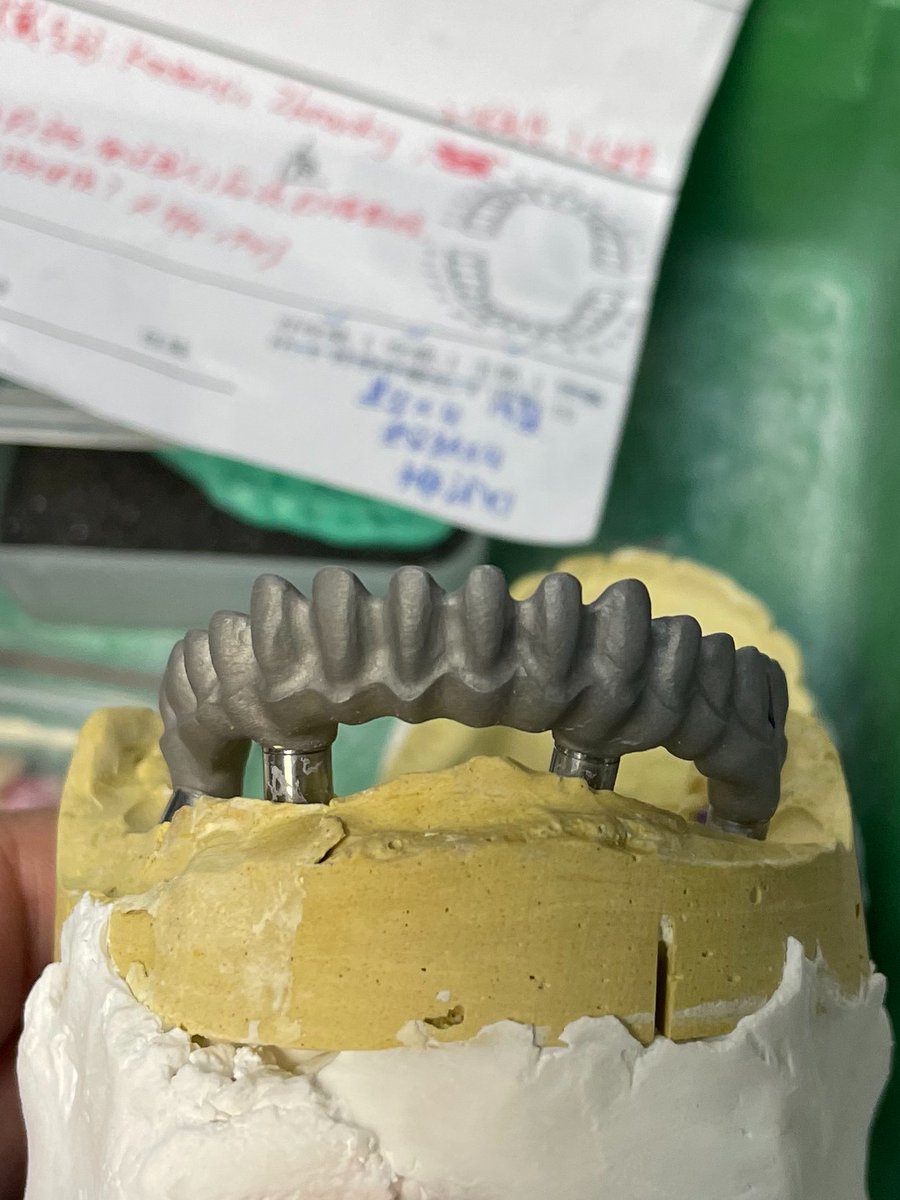 jackwangzixiao's tweet photo. Cast implant all in 4. https://t.co/hQ6z5K2gsX