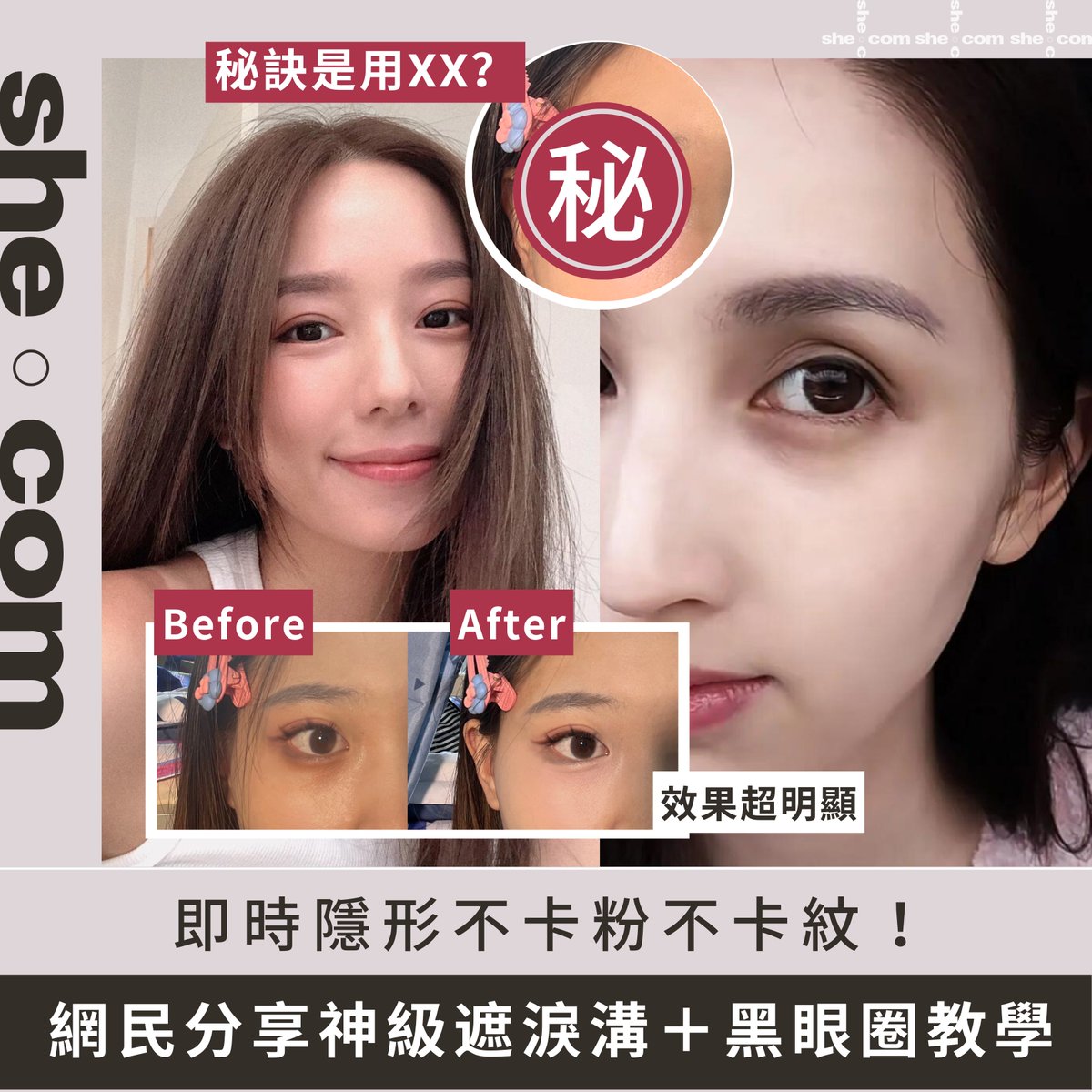 shecom's tweet photo. 即看全文：https://t.co/GeFNmF6NXw
淚溝與黑眼圈是最常見的眼部問題，不但使人看起來無精打采，更會視覺上極為顯老！若然只是一味塗抹厚厚的遮瑕膏，除了會愈遮愈黑，更有機會出現卡粉起紋的尷尬情況。有網民就分享一招超實用的遮瑕教學，只需3大步驟就能輕鬆遮掉淚溝及黑眼圈！
#shebeauty #遮瑕 https://t.co/f9KyVyqE0a