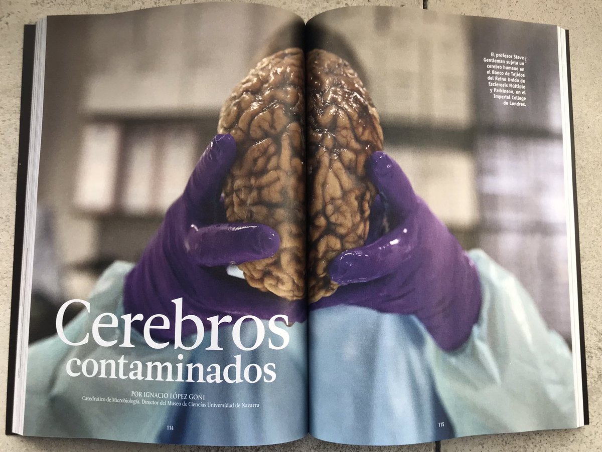 microBIOblog's tweet photo. “Cerebros contaminados”: del kuru de los caníbales a las vacas locas, pasando por el “scrapie” de las ovejas ➡️ priones, proteínas infecciosas. En el último (ed coleccionista) de @muyinteresante @EugenioManuel https://t.co/BO8qRNwYui