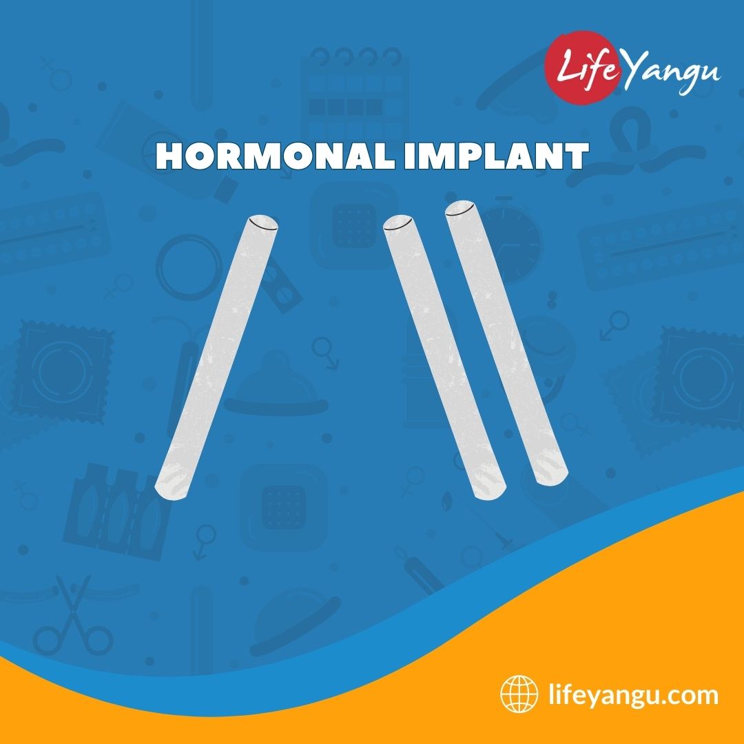 Life_Yangu's tweet photo. Did you know that the contraceptive implant is inserted under the skin of a woman's upper arm to prevent pregnancy?

Visit https://t.co/cmUcOYuDzq to find out how it works and for how long.

#Lifeyangu #YouthnaContraceptionKE https://t.co/O99o42mdHp