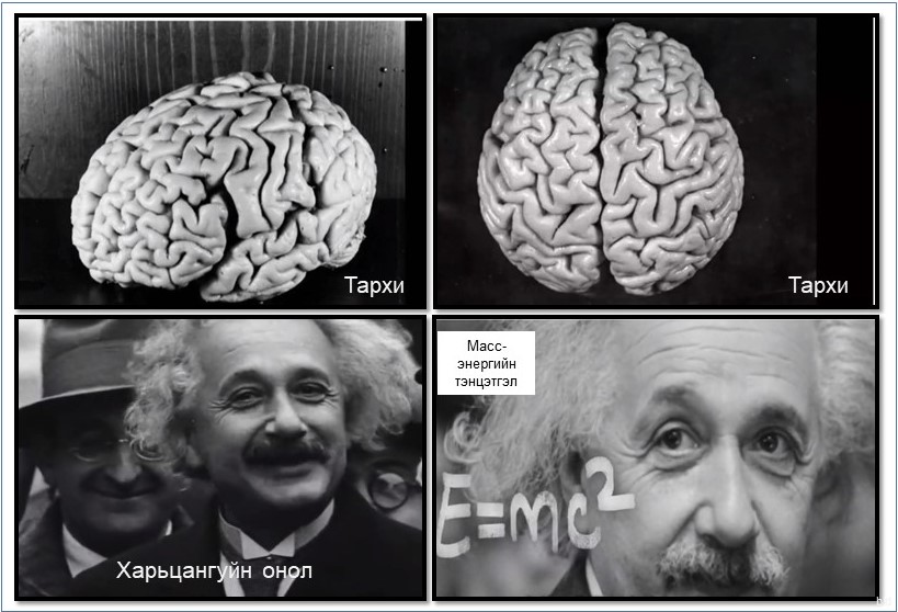 Альберт Эйнштейн тархийг нас барснаас нь хойш 7 цагын дотор гарган авч. Тархины багтаамжын хувьд энгийн хүнээс бага. 1250 г орчим. Задлан шинжилгээгээр glial гэдэг эс маш олноор оршиж байж. Энэ эсийн үүрэг нь мэдэрлийн эсүүдэд хүчил төрөгч болон шим тэжээл дамжуулах үүрэгтэй.