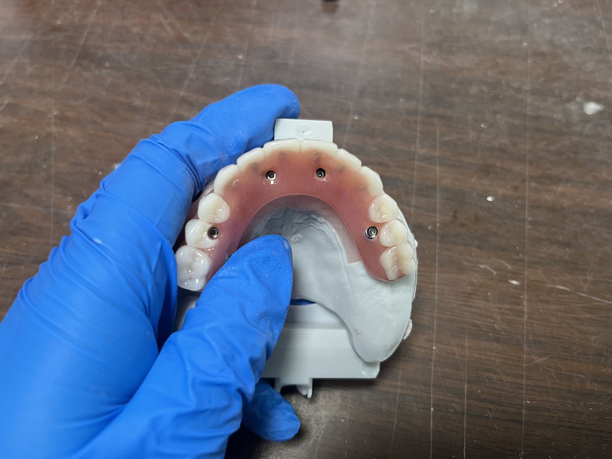 CosmosDentalCN's tweet photo. I have to take a photo before the packaging😃
#Dentallab #crownmanufacturer #crown #bridge #allon4 #denture #lab #fulldenture #screw https://t.co/Tmv47JUjJF