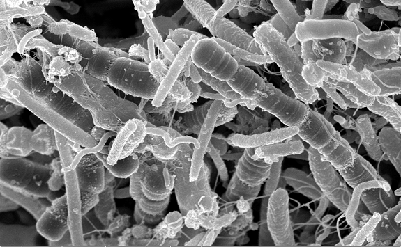 BIOLOGY/BMS External Seminar - Dr James Connolly @UniofNewcastle Biosciences Institute (NUBI): Unique mechanisms of gene expression control in distinct Escherichia coli pathotypes. Wednesday 10th May, 1-2 pm, BMS Seminar Room RM001. Hosted by @DocAndreasHaag