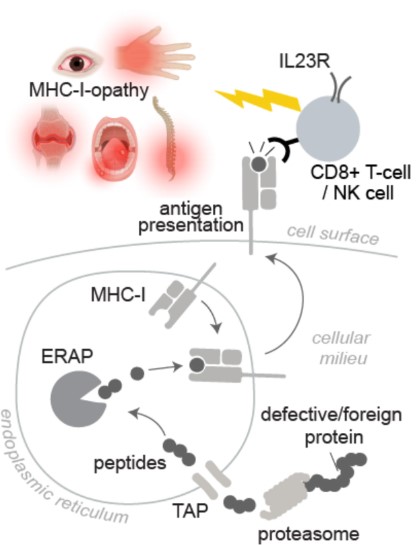 Interested in MHC-I-opathies? Check out the new insights into this concept and the introduction of the @eular_org study group: ▶️ standardization ▶️ collaboration ▶️ improving patient management 🔗 bit.ly/3nx7RJG @TonyKenna3 @jonas_kuiper