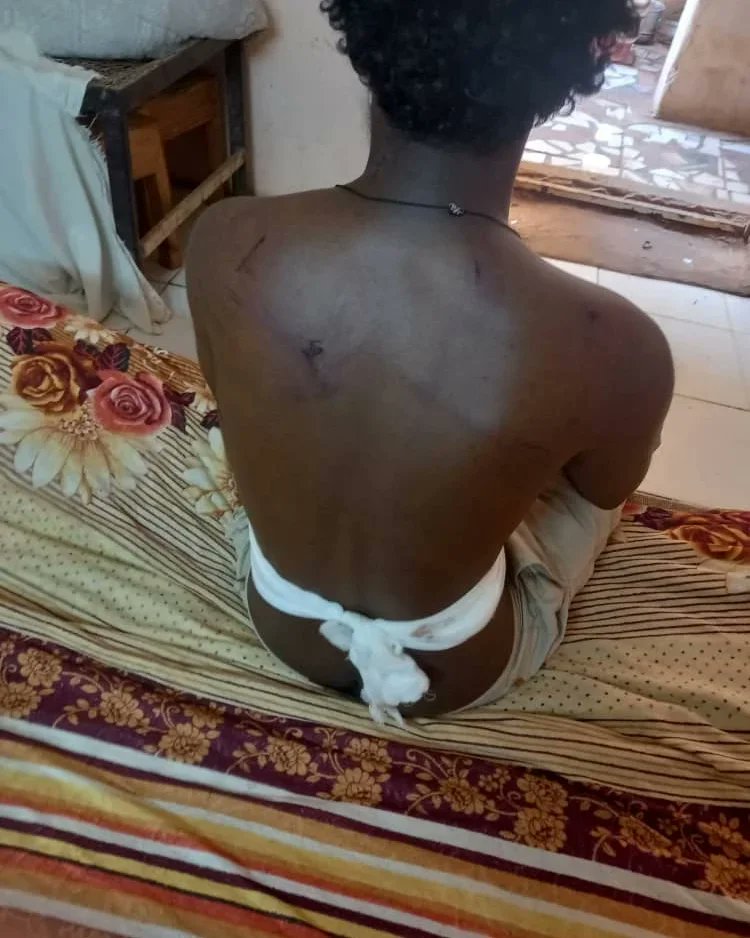 AbubakrFawaz's tweet photo. 1مايو تعرضت لي طلق ناري من قبل قوة الدعم السريع انا كنت أقوم بواجبي لتغطية الأحداث في الخرطوم
نحن الصحفيين الان ليس في امان https://t.co/b8ff7xFrly