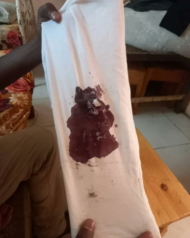 AbubakrFawaz's tweet photo. 1مايو تعرضت لي طلق ناري من قبل قوة الدعم السريع انا كنت أقوم بواجبي لتغطية الأحداث في الخرطوم
نحن الصحفيين الان ليس في امان https://t.co/b8ff7xFrly