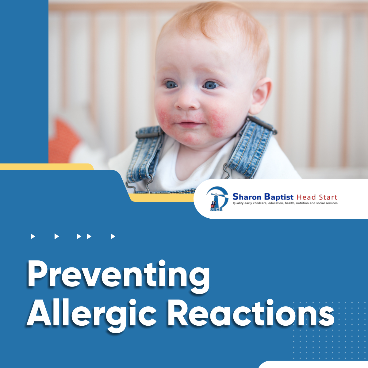 Children may not be cautious about what they eat. As a result, they may eat or have contact with food that causes an allergy. 

Read more: facebook.com/sharonbaptisth…

#Childcare #AllergicReactions #Allergies