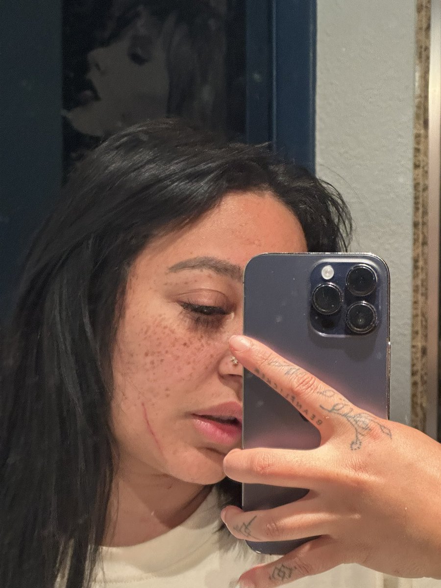 emily cheree on Twitter: "My tegu bit my nose when I was kissing her