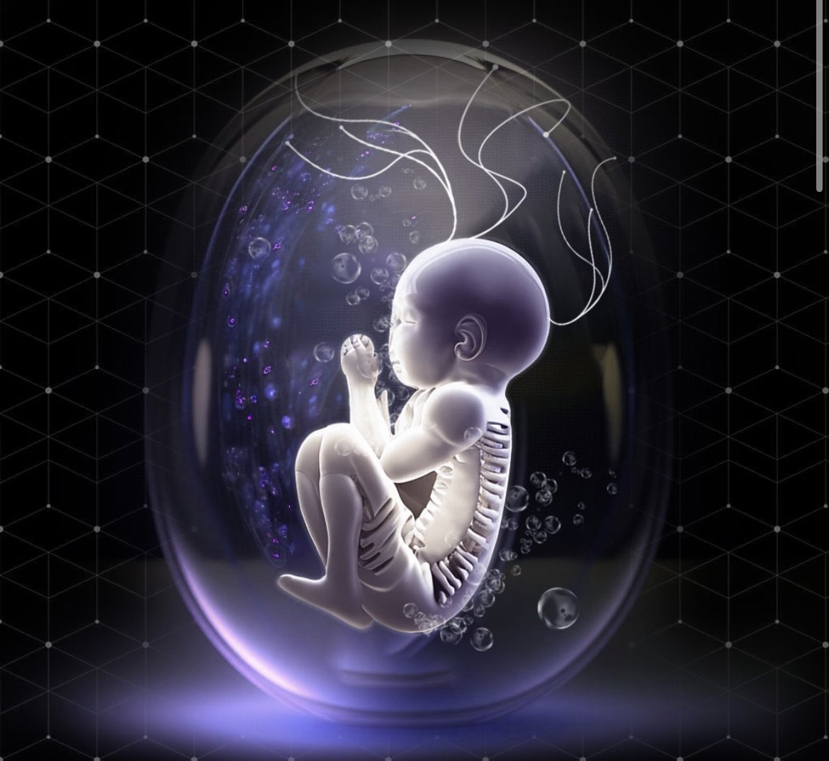 Metaverse_SC's tweet image. First RPG blockchain character development system ❤️ 

Upgradable stats ! wow 🤩

Strenght +3
Speed +2

Follow @Metaverse_SC 

#nft #NFT #nftart #NFTartwork #NFTCollection #Ethereum #NFTGiveaway #NFTdrop