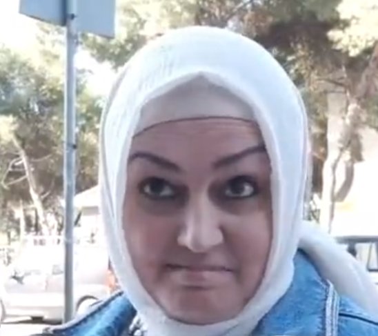 Bir reddit kullanıcısı yapay zeka kullanarak beyni olmadan yaşayan bir insan modeli oluşturdu.
#DoktorDövebiliyoruz