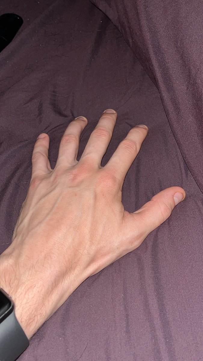 Damnit_Derek's tweet photo. #hands #vascular #choking #nsfw https://t.co/B3ZlK6yLnR