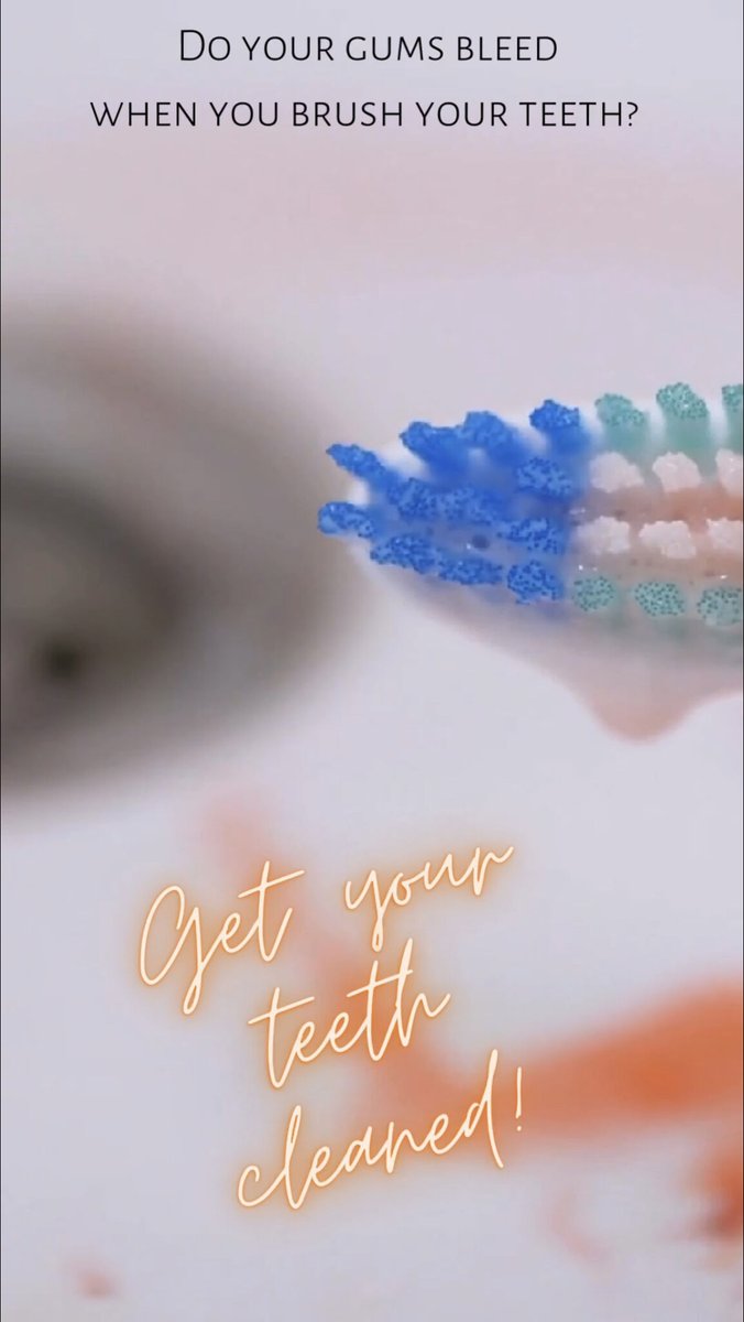 AllSmilesAllen's tweet image. Healthy gums don’t bleed. If your gums bleed when you brush or floss your teeth, it is time for a teeth cleaning! Give us a call today at (972)747-1996 or book an appointment online at: bit.ly/3FqH8Vs
