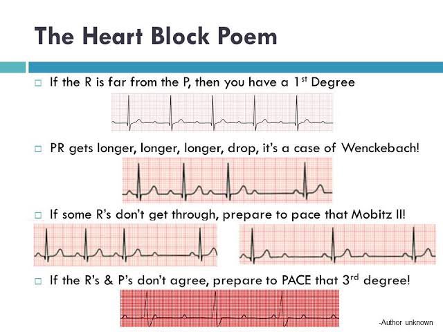 Gave a lecture on bradyarrhythmias to our famed colleagues earlier today and this poem came in handy.