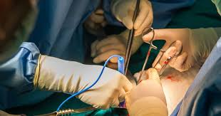 Nephrol00976063's tweet photo. Medical researchers have successfully performed a groundbreaking kidney transplant using 3D-printed organs, paving the way for more efficient and accessible organ donations in the future. #kidneytransplant #medicalinnovation #3Dprinting https://t.co/HPTHYKXd92
