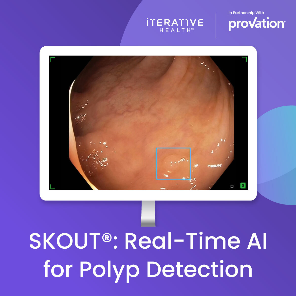 We're thrilled to announce that SKOUT®: real-time AI for polyp detection, will soon be available to gastroenterologists throughout the United States. Learn more about the latest technology for enhanced adenoma detection here: businesswire.com/news/home/2023…

<a href="/provationmed/">Provation</a>