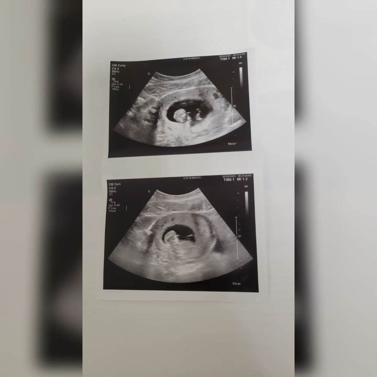 Rebecca_Orr24's tweet photo. Yesterday we had our first appointment and I'm 11 weeks along!! We got our first ultrasound, too! I'm so excited for you to come into this world, my little one 🥰❤️✨️ https://t.co/dFO3EIXnQW