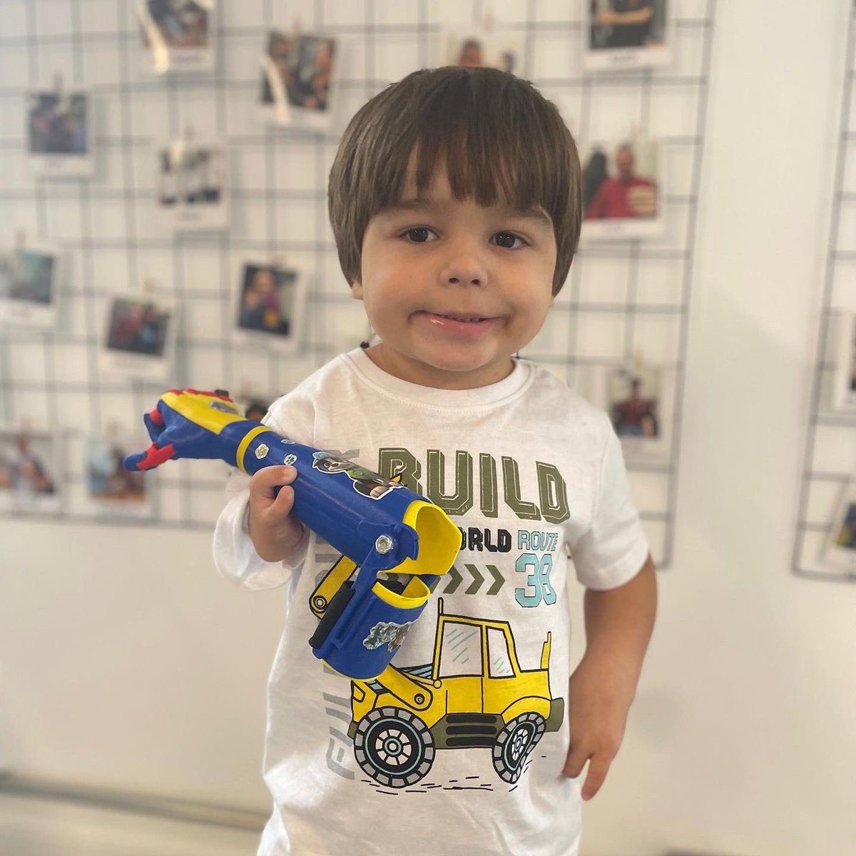 Rafa, tiene 4 años y es del Chuy, Rocha. 
Su mamá se animó y nos escribió: 

“Rafa nació con anomalías en sus miembros superiores, hace un tiempo comenzó a descubrirse y a mirarse mucho al espejo, comenzó a preguntarnos por qué es así y qué le pasó.