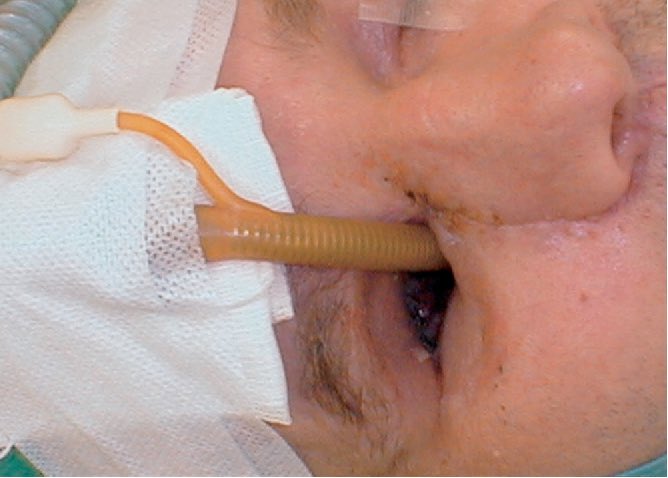 OGdukeneurosurg's tweet photo. Explain please. (Reference to Article to Follow) https://t.co/FRnSQCCWlS