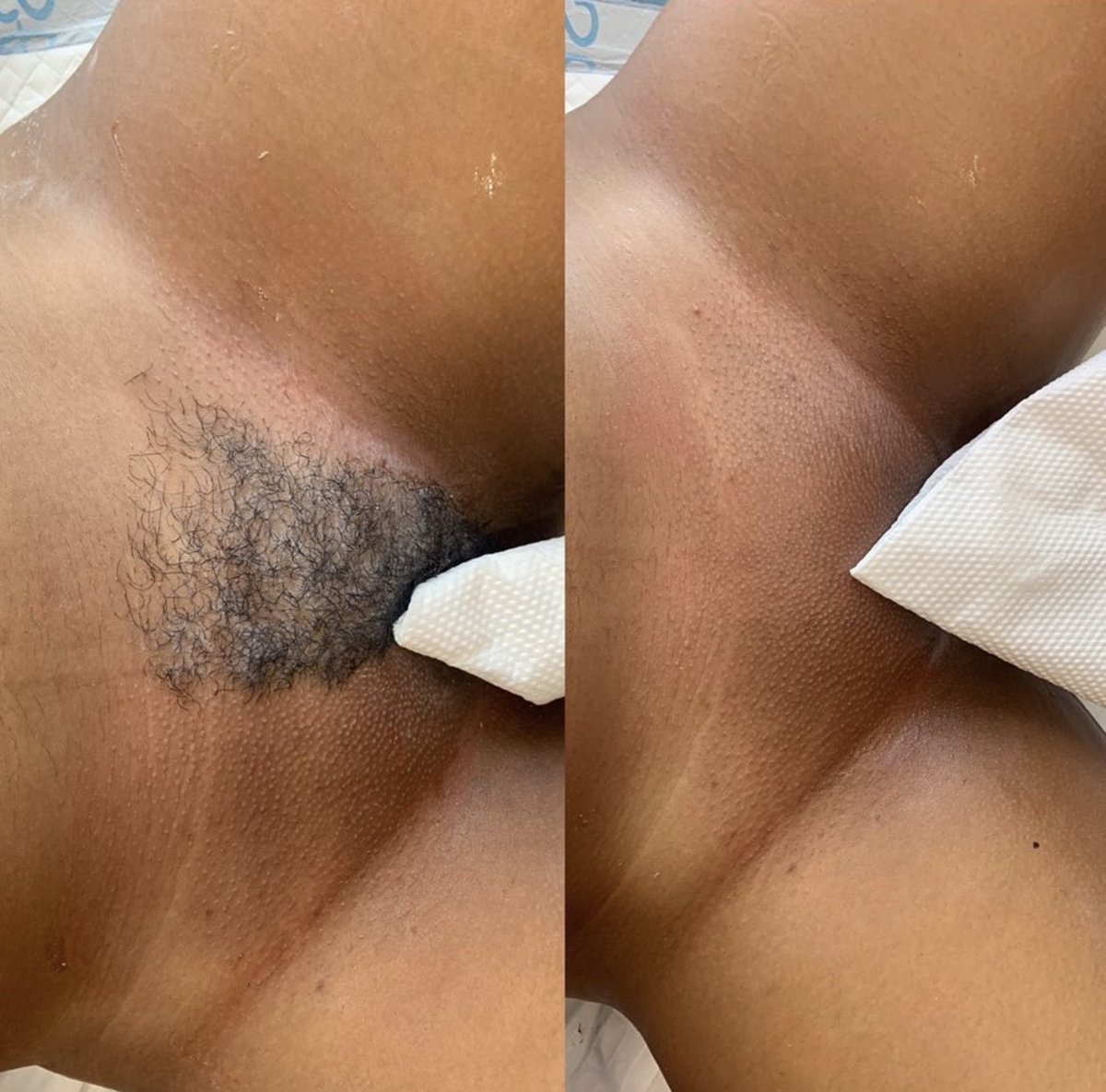 JustPeachyja's tweet photo. Why would you settle for less ? 🥰 #BrazilianWax https://t.co/c7u8TwTdVq