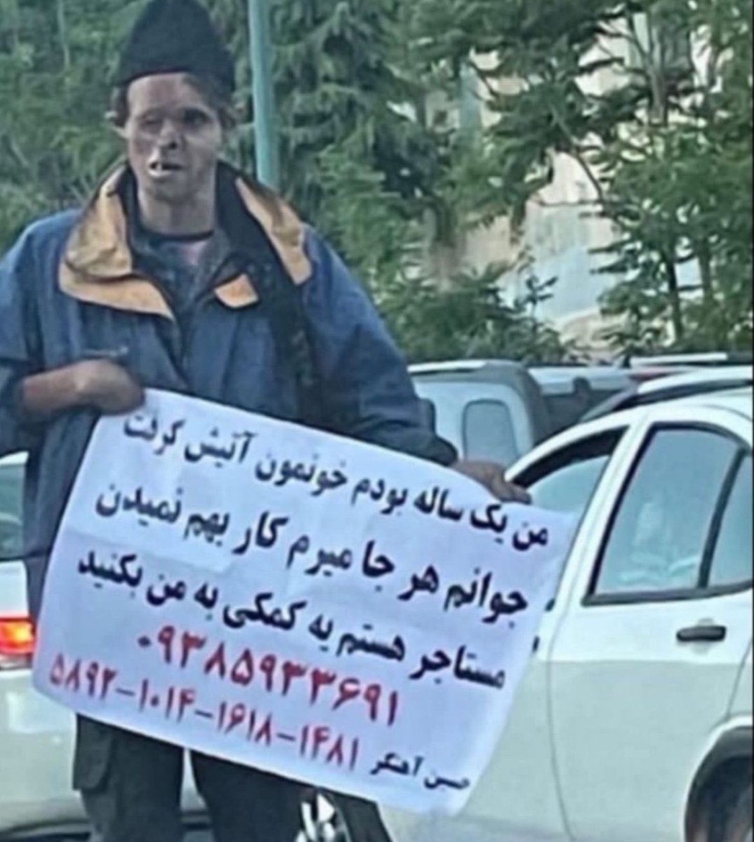 AfsoOneShaaaM's tweet photo. لطفا اجازه بدید دیده شه کمکش کنن
جوونه خیلی مظلومه 🥺💔😞 https://t.co/G4Stq4bWeV