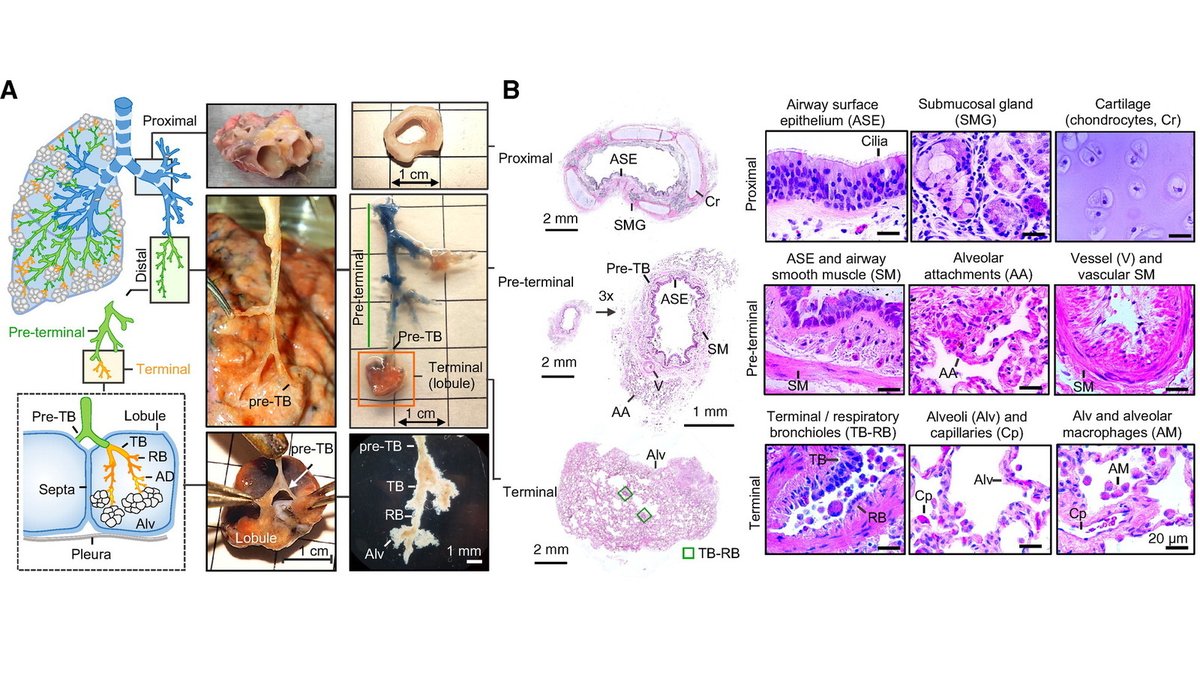 A Unique Cellular Organization of Human Distal Airways and Its Disarray in Chronic Obstructive Pulmonary Disease

🔗 bit.ly/3oRadUt